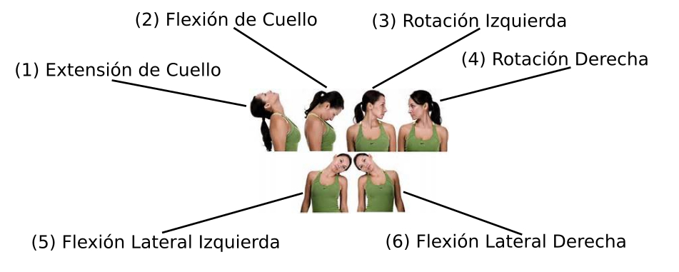 Figura 2 Posiciones básicas de la distonía cervical. 1. Extensión de cuello. 2. Flexión de cuello. 3. Rotación izquierda. 4. Rotación derecha. 5. Flexión lateral izquierda. 6. Flexión lateral derecha.
